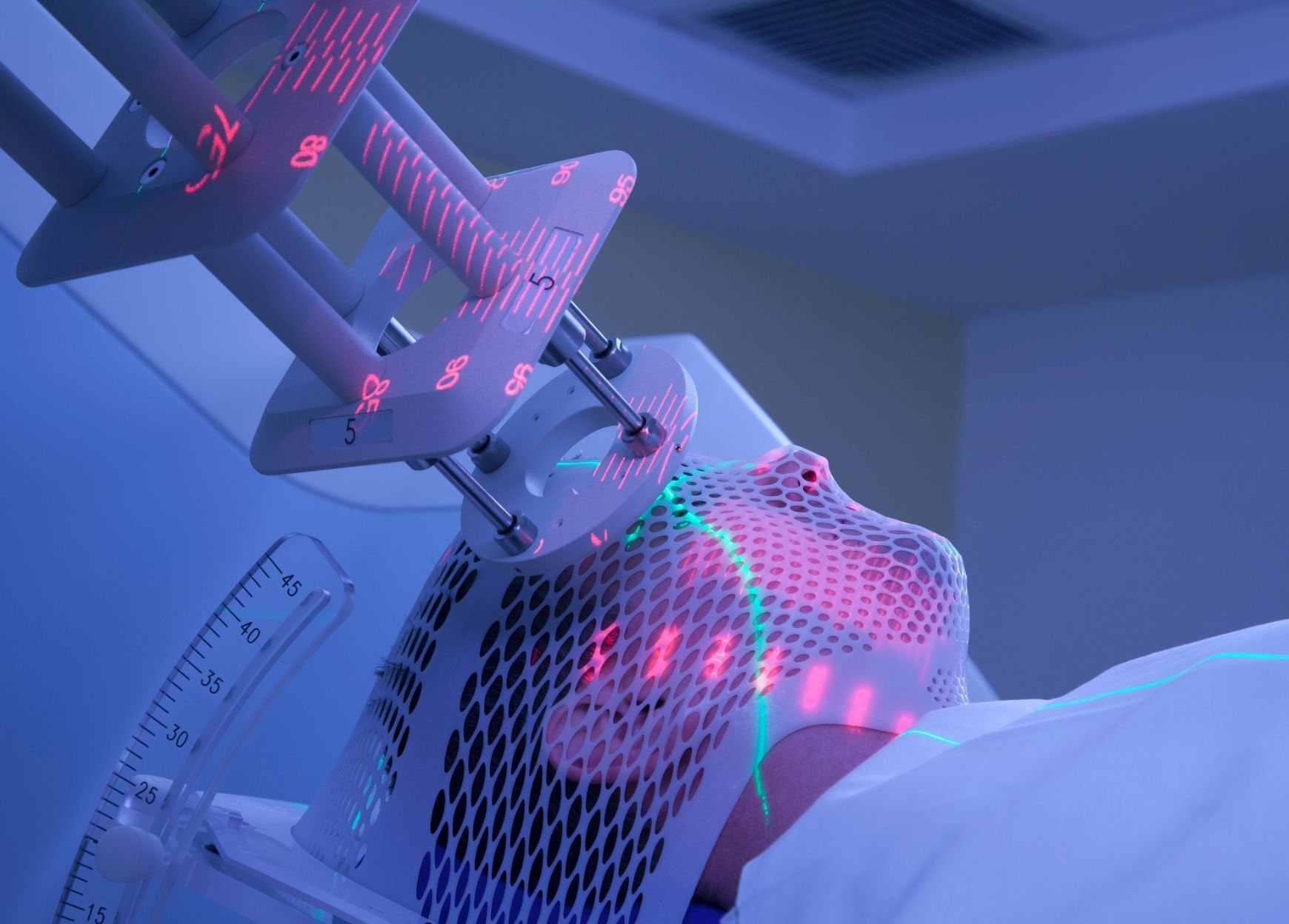 medical - Radiation therapy